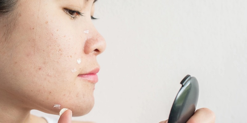 Lưu ý khi chăm sóc da dầu mụn mùa Đông